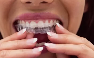 Invisalign Portland: Clear Aligner Therapy for Discreet Orthodontic Correction